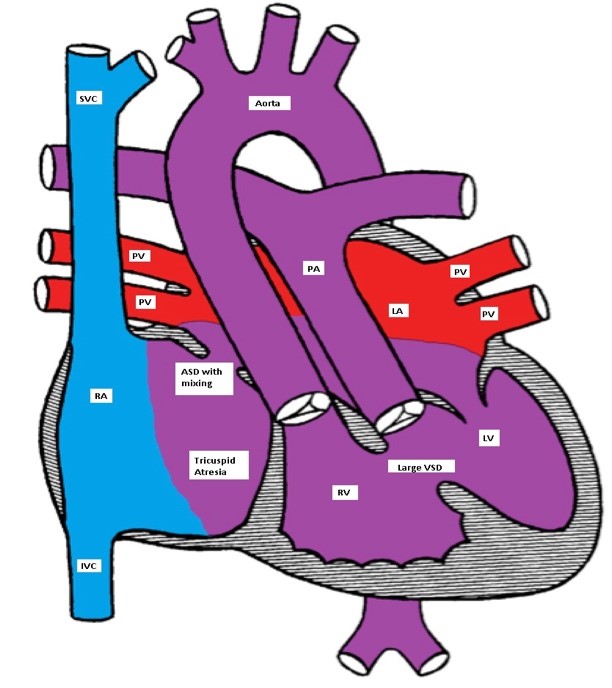 Figure 4b